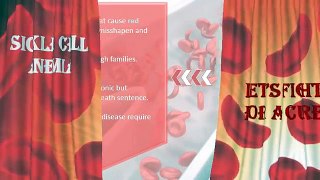 Sickle Cell Anemia Treatment - What Should You Know About it?