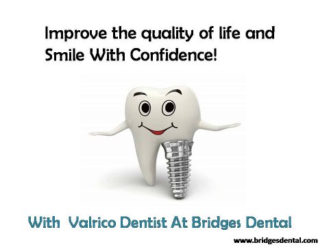 Valrico Dentist: Give your Smile Back With Dental Implants
