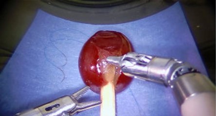 Hassas Cerrahi İşlemler İçin Kullanılan Da Vinci Robotu