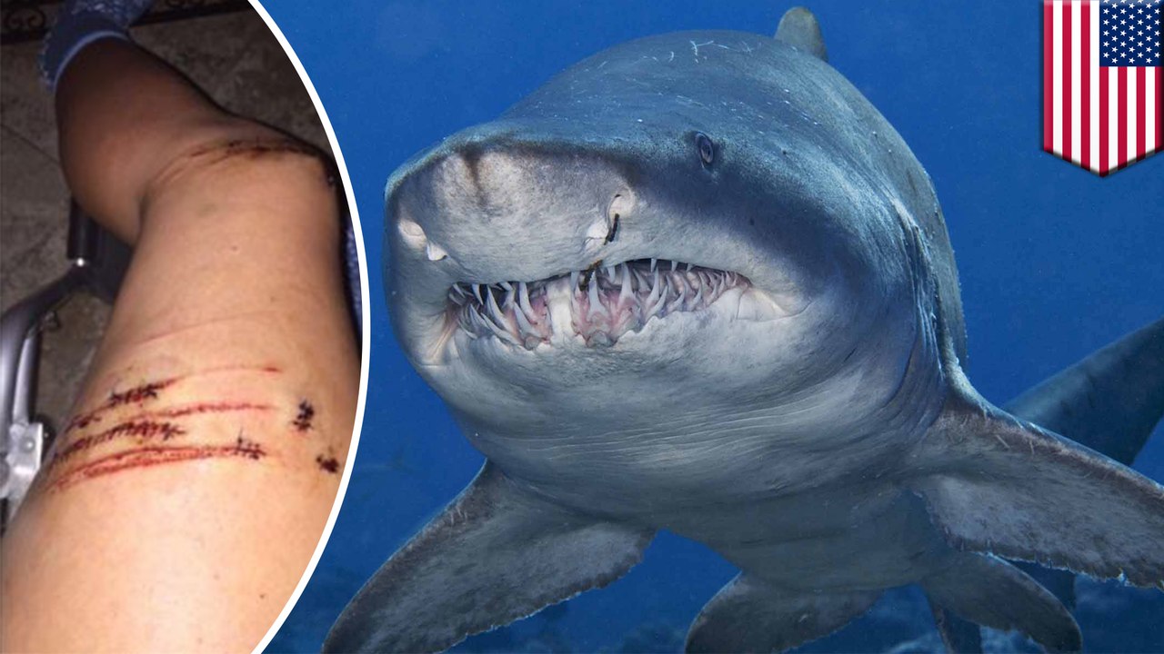 Shark attack survivor: girl escapes attack by going all United on shark - TomoNews