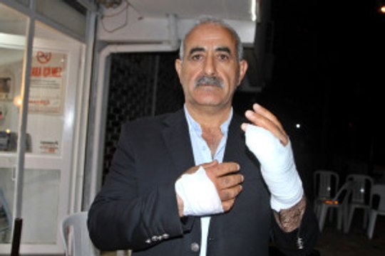 Antalya'da 'Evet' Standında ''Neden Evet Diyeceğiz Yumruğu: 4 Yaralı