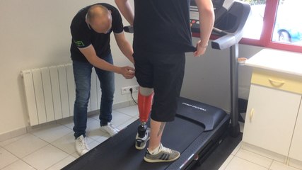 Une prothèse de pied électronique et étanche