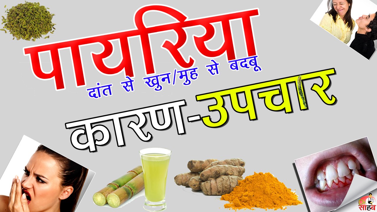 पयरिया और सासों की बदबू के घरेलु उपचार -Home remedies for|| pyorrhea and Bad breath