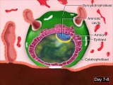 Implantation