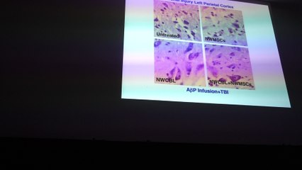 Aruna Sharma's work Parkinson's Disease & Brain Injury treatment with Cerebrolysin Hari Sharma Brain 2017 Apr 02, 2017