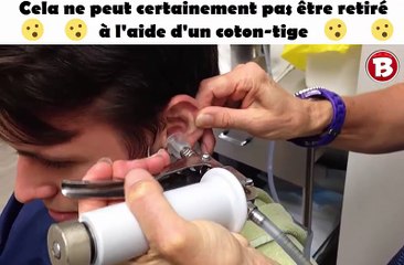 cela ne peut certainement pas être retiré à l'aide d'un coton-tige