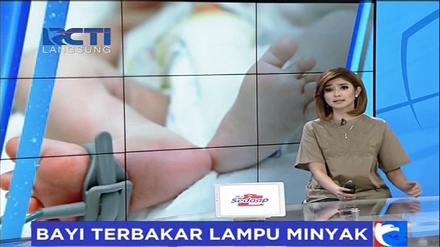 Akibat Lepas Pengawasan Orang Tua, Bayi Terbakar Lampu Minyak