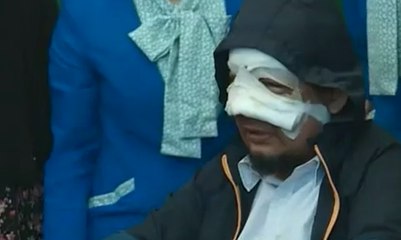 Usut Pelaku Penyiraman Air Keras Terhadap Novel