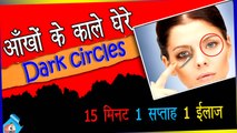 Dark Circles under Eyes,Dark Circles Treatment-Homeremedies-डार्क सर्किल के घरेलु उपचार [Hindi]