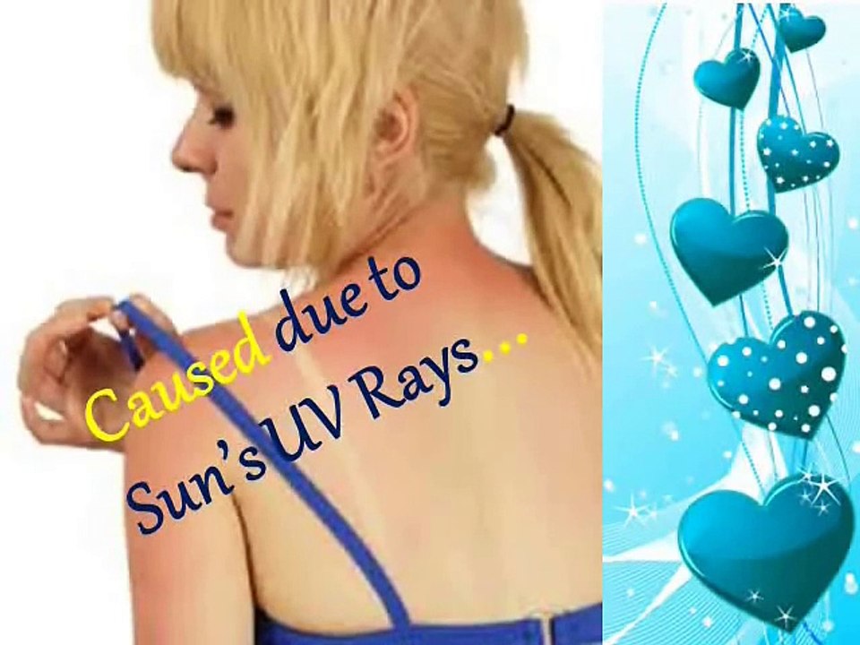 How to Remove Sun Tan From Your Body Immediately