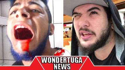 Chentric preso nos Açores! Everson arranca dente com Alicate! T7agox, OurMine, Windy GirkTV