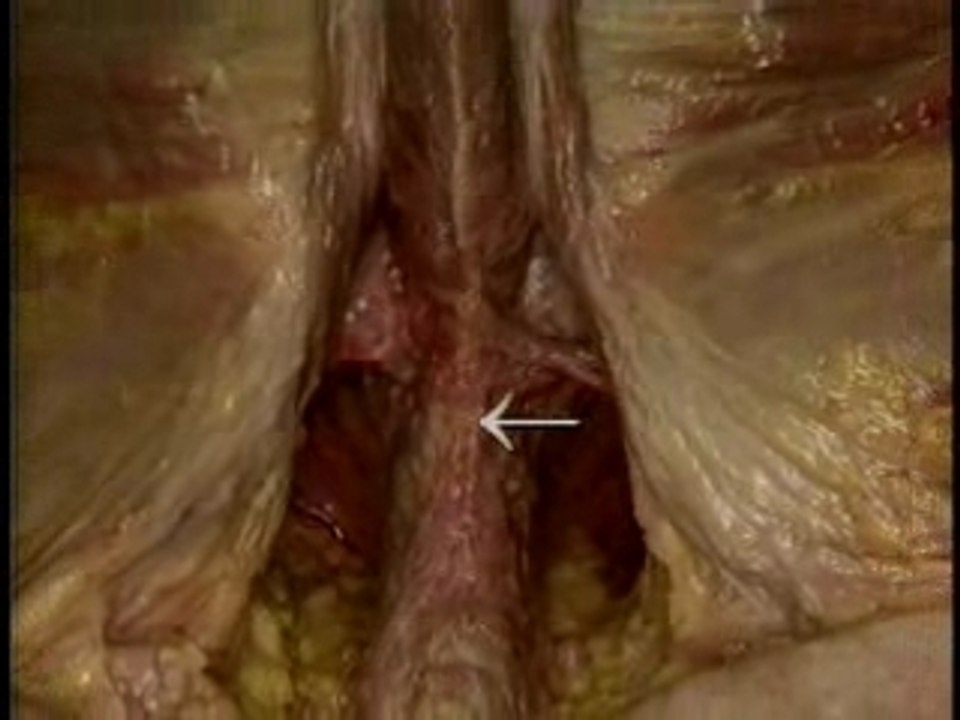 Perineum: muscles