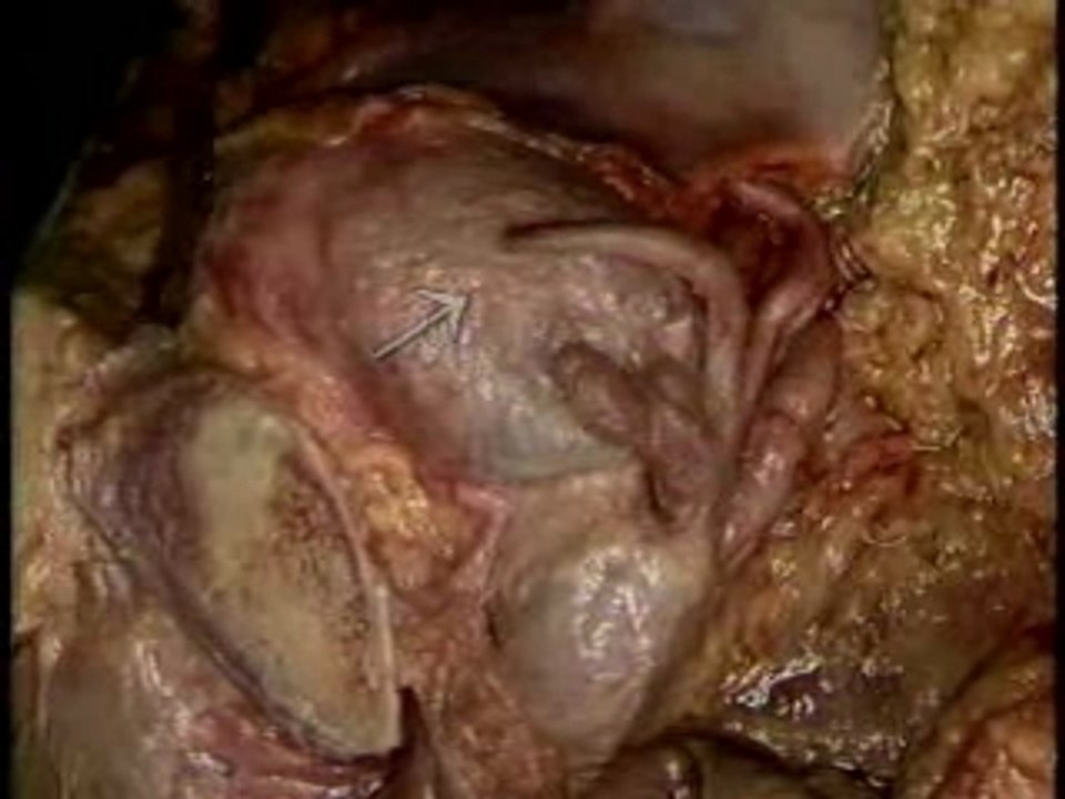 Male Reproductive System-5