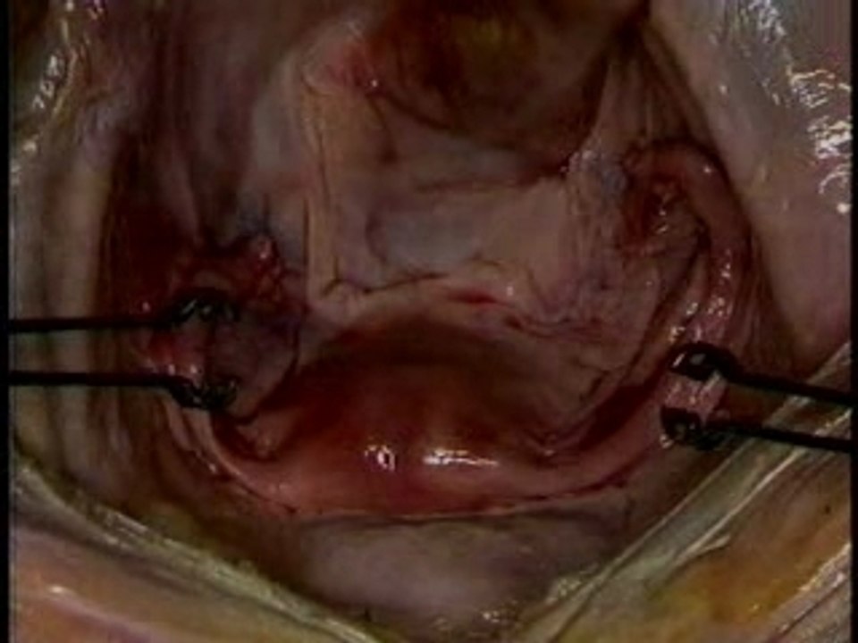 Female Reproductive System-1