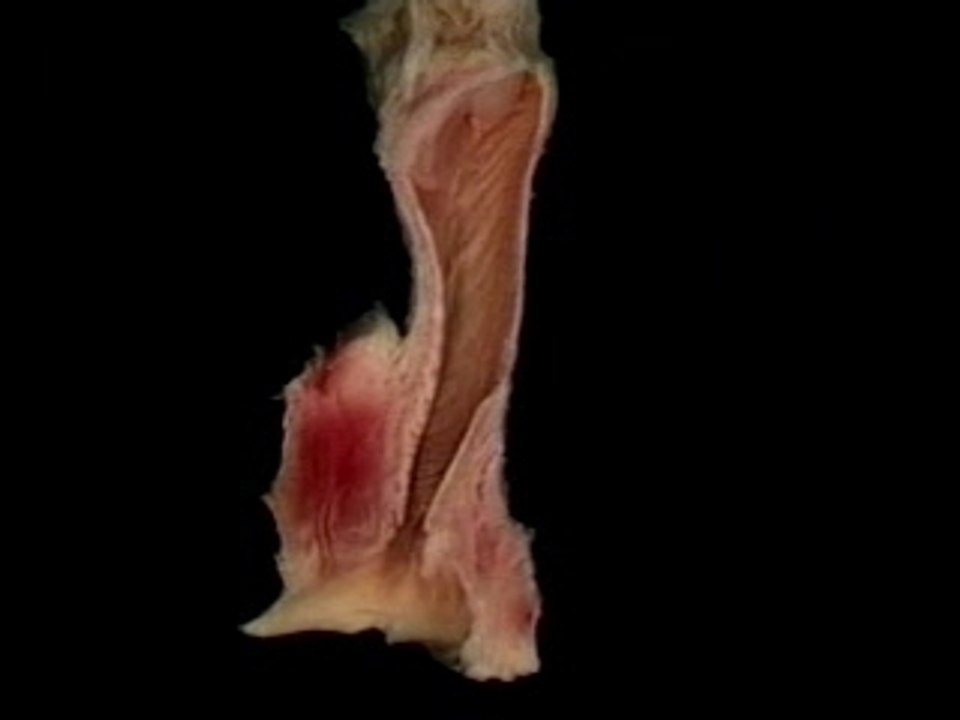 Female Reproductive System-4
