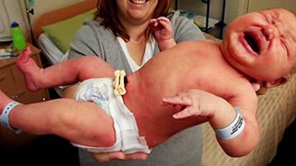 Nacio el Bebe Mas Grande Del Mundo!