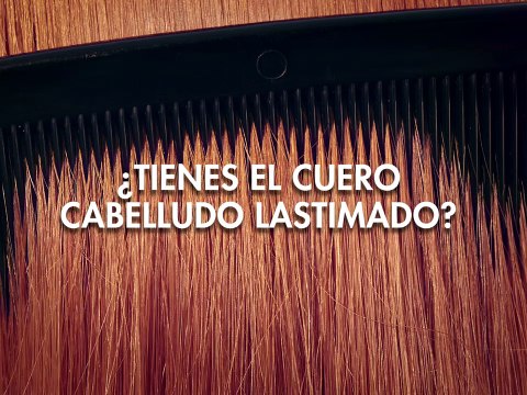 ¿TIenes el cuero cabelludo lastimado?