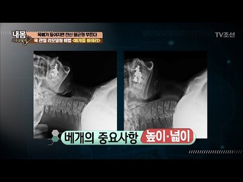 목 관절을 지키려면 베개를 바꿔라! [내 몸 사용설명서] 148회 20170407