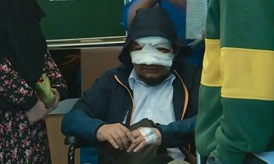 Tim Medis Pastikan Kesehatan Jaringan Mata Novel