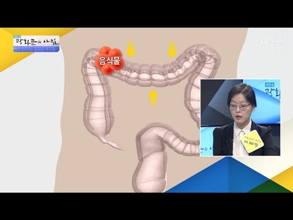 높아지는 대장암 발병률! 원인은? [광화문의 아침] 454회 20170403
