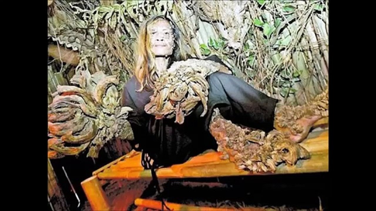 Tree Man