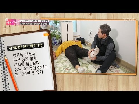 전문의가 말해주는 다리 부기 빼기 TIP [엄마의 봄날] 82회 20170326