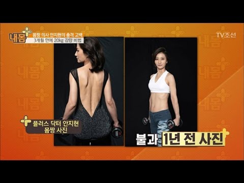 플러스 닥터 안지현, 20kg 감량 전 사진 공개! [내 몸 플러스] 51회 2017...