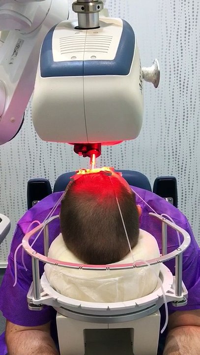 Robot Amovible pour prelever les_greffons