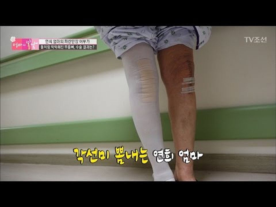 수술을 마친 엄마! 무릎 건강은 물론 각선미까지 되찾았다? [엄마의 봄날] 79회 2...