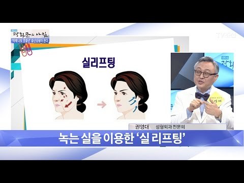 성형외과 전문의가 얘기하는 필러와 리프팅 [광화문의 아침] 430회 20170227