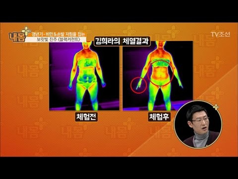 손발 저림을 잡아주는 블랙커런트! [내 몸 플러스] 47회 20170226