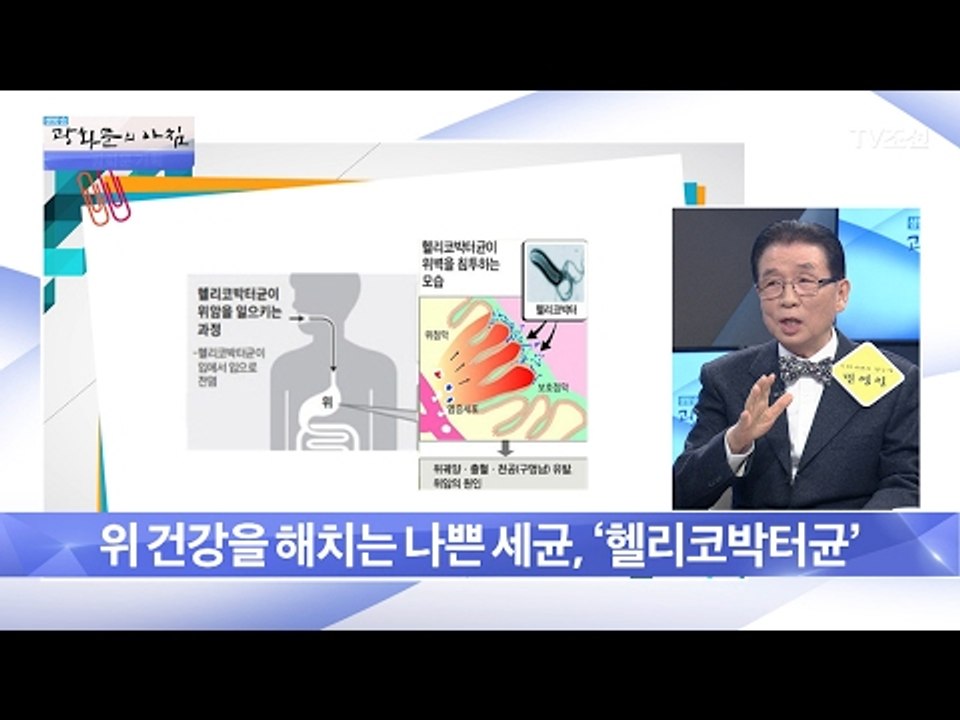 소금, 위암을 부를 수 있다?! [광화문의 아침] 425회 20170220