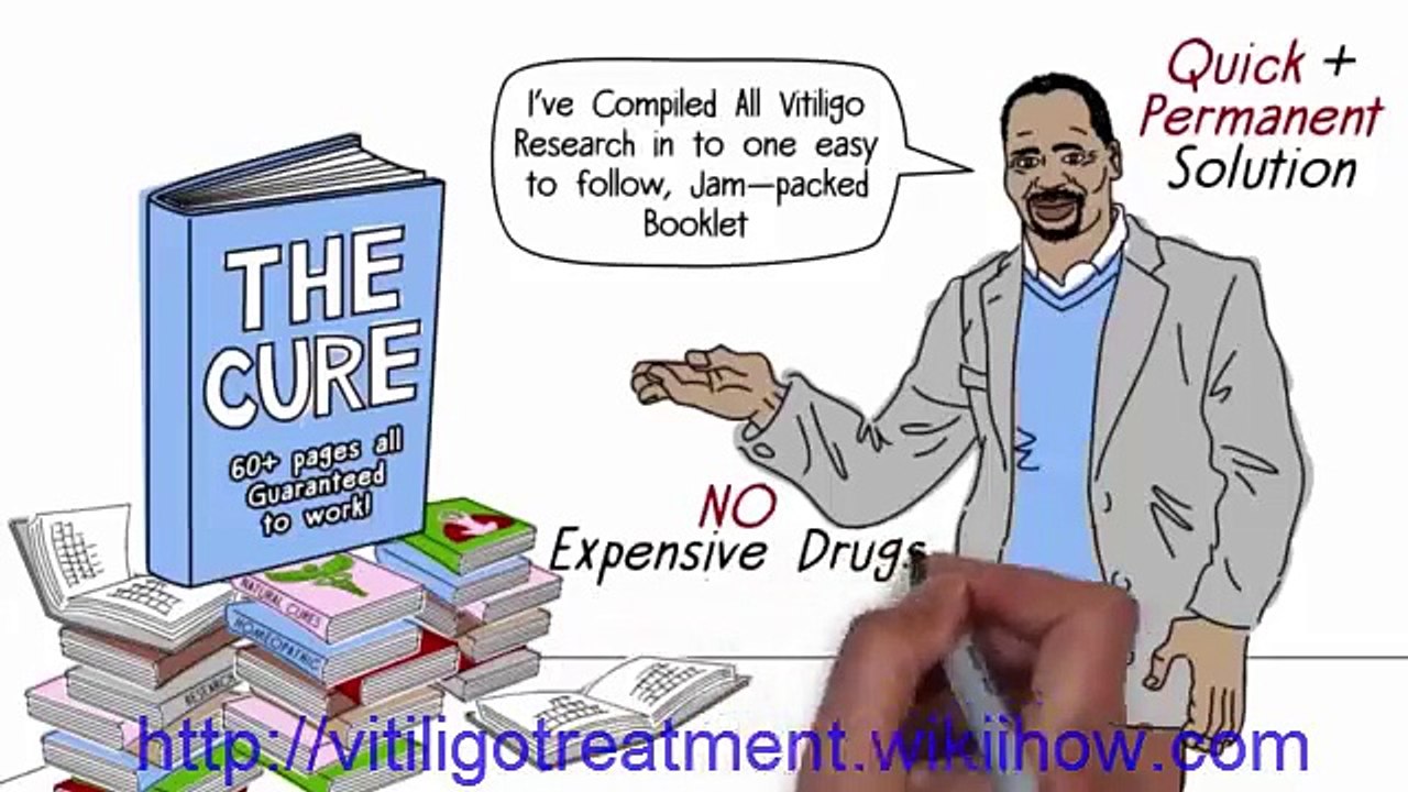 Vitiligo Cure: 10 Natural Home Remedies for Vitiligo Disease