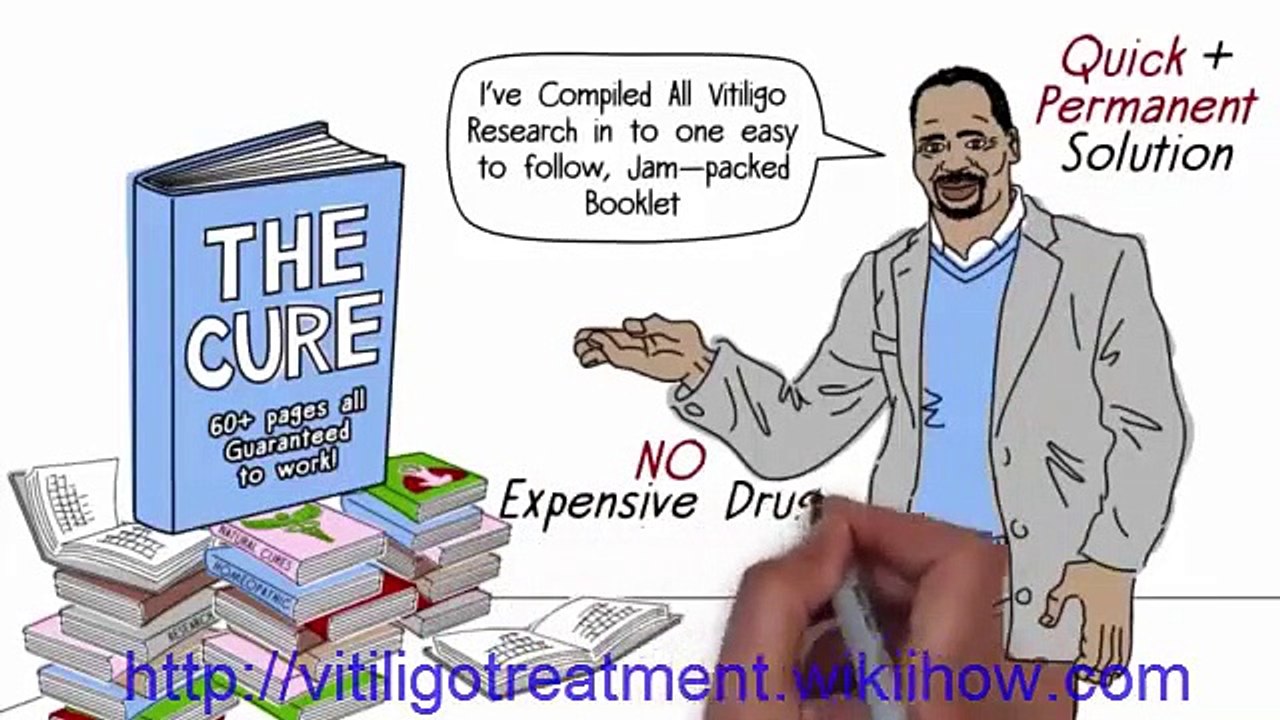 vitiligo ayurvedic treatment