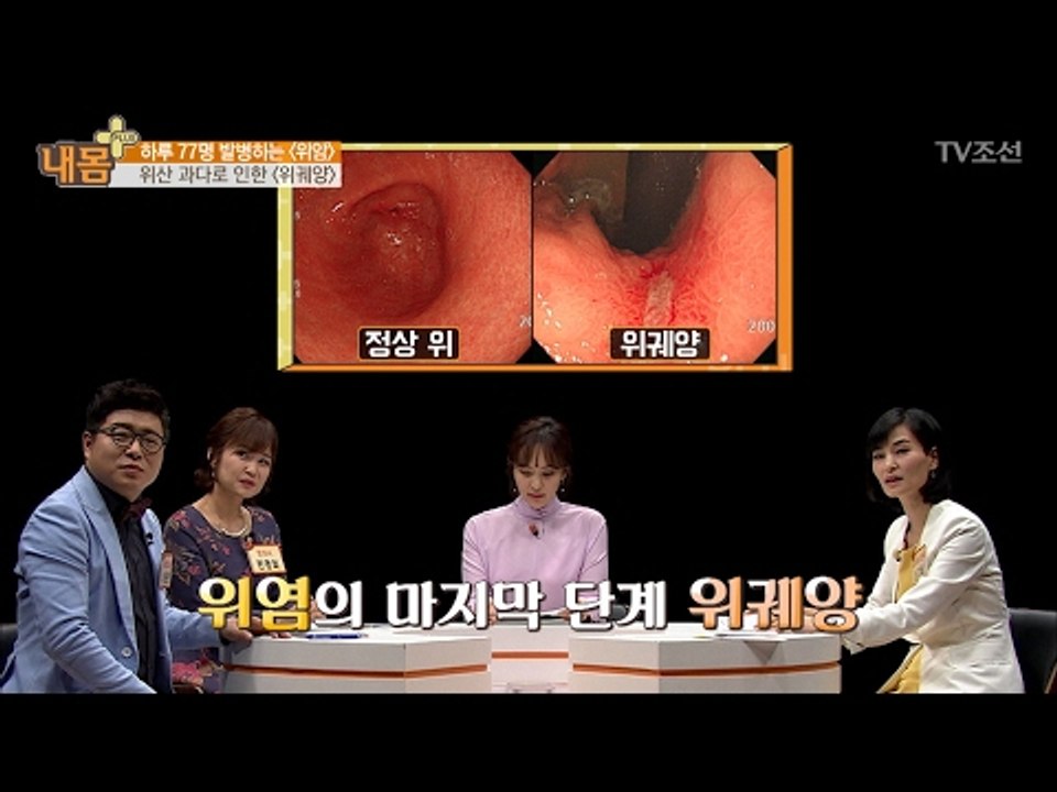 위산 과다가 위염을 부른다? [내 몸 플러스] 46회 20170219