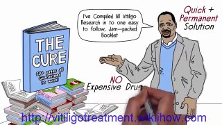 vitiligo cure natural treatment