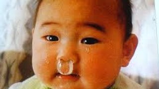 Baby with Runny Nose || Yakhi Baby || Can't Stop Laughing