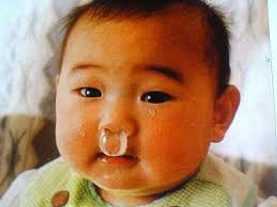 Baby with Runny Nose || Yakhi Baby || Can't Stop Laughing