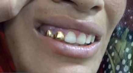 Antep'te Altın Dişli, Son Model Telefonlu Dilenciler Şaşkına Çevirdi