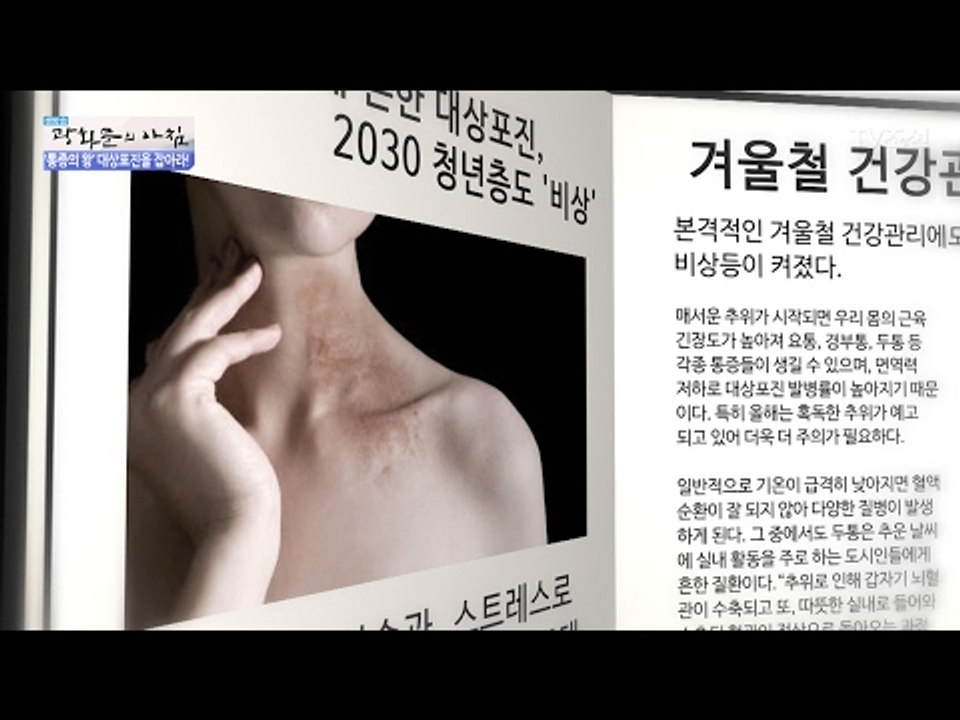 감기와 비슷한 대상포진, 발병 원인은? [광화문의 아침] 419회 20170210