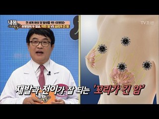 유방암의 두 얼굴, 착한 암? 꼬리가 긴 암? [내 몸 사용설명서] 141회 20170210