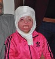 Suriyeli Minik Ayşe'nin Dramı