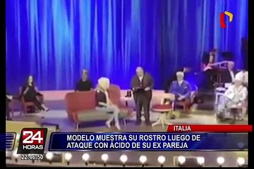 Modelo muestra su rostro tras ser desfigurada con ácido por exnovio