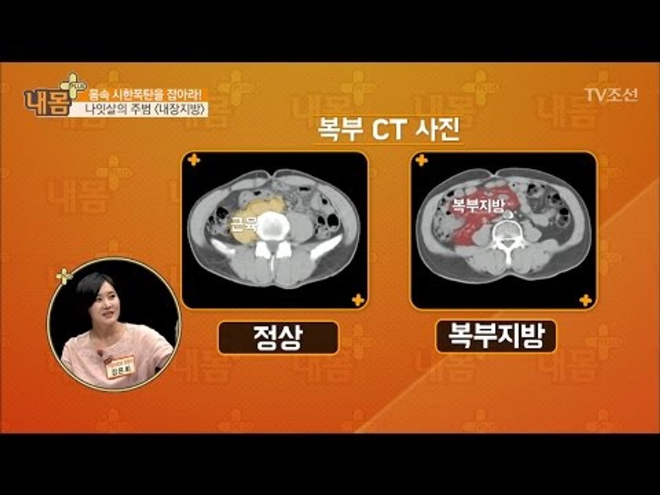 나잇살의 주범, 내장지방! [내 몸 플러스] 43회 20170129