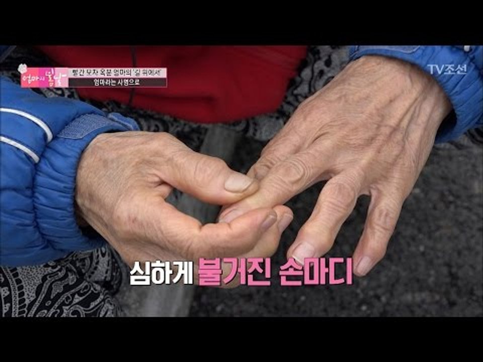 통증이 밀려와 일을 하지 못하는 엄마 [엄마의 봄날] 74회 20170129