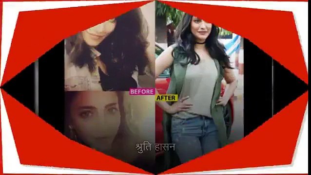 Katrina Kaif, Priyanka Chopra, Aishwarya , Bollywood actresses who went for Lip Job | Filmibeat