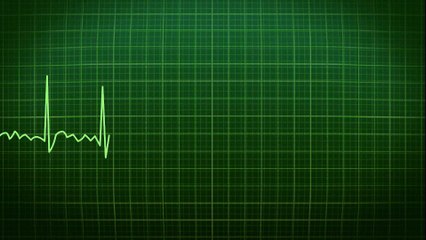 ECG for human body Full HD released by NCV