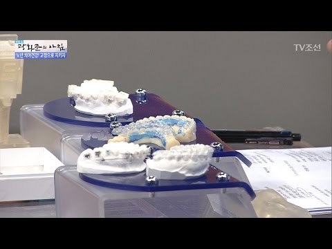 디지털 기술로 만든 완벽한 교정 장치들! [광화문의 아침] 407회 20170123