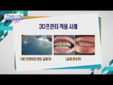 3D프린터로 교정기를 만들다! [광화문의 아침] 407회 20170123