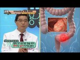 대장암 골든타임 1초, 대변 상태를 체크하라! [내 몸 사용설명서] 138회 20170120